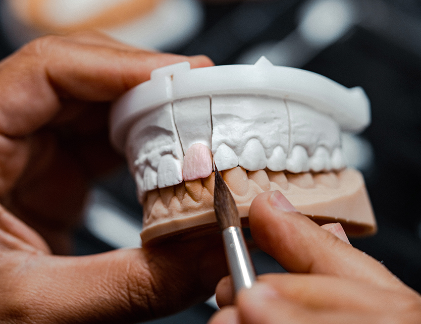 A person is meticulously painting a pink hue onto a dental model using a small brush. The model displays a detailed representation of human teeth, with the upper portion supported by a white base.