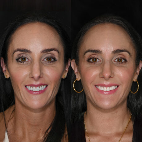 A side-by-side comparison of two similar images of a woman with dark hair, smiling. Both photos show her wearing earrings and makeup, with subtle differences in lighting and angle.